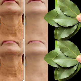 Liść laurowy jest 100 000 razy silniejszy niż botoks? | Naturalny środek na rozwiązanie nawet w wieku 70 lat!