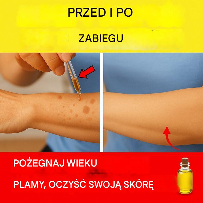 Jak zwalczać plamy starcze