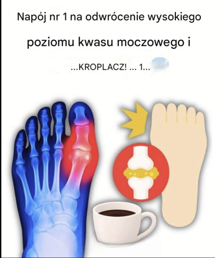 „Mój duży palec u nogi płonął… dopóki nie odkryłem tych 5 napojów, które naturalnie eliminują kwas moczowy!”