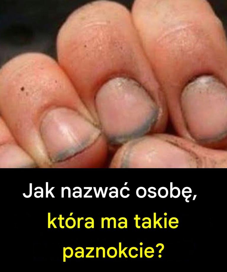 Jak nazwać osobę, która ma takie paznokcie?