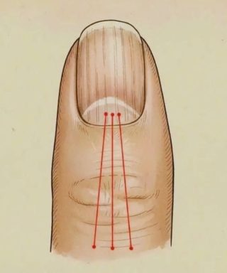 Co jeść, aby zmniejszyć bruzdy na paznokciach: poradnik żywieniowy dla zdrowszych paznokci