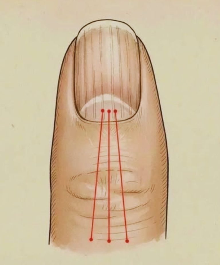 Co jeść, aby zmniejszyć bruzdy na paznokciach: poradnik żywieniowy dla zdrowszych paznokci