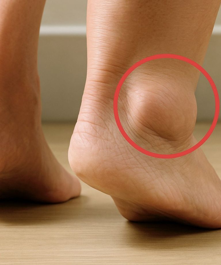 Obrzęk stóp u osób starszych: najczęstsze przyczyny i sposoby zapobiegania